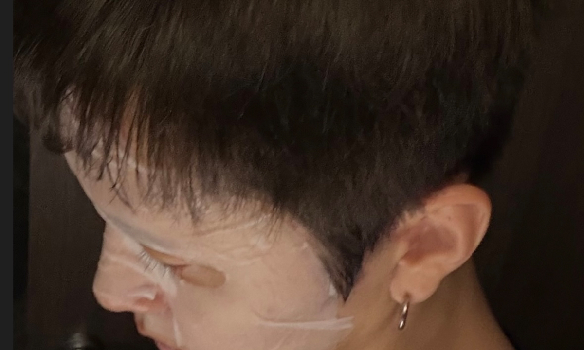 용준형, 탈모설 해명했다